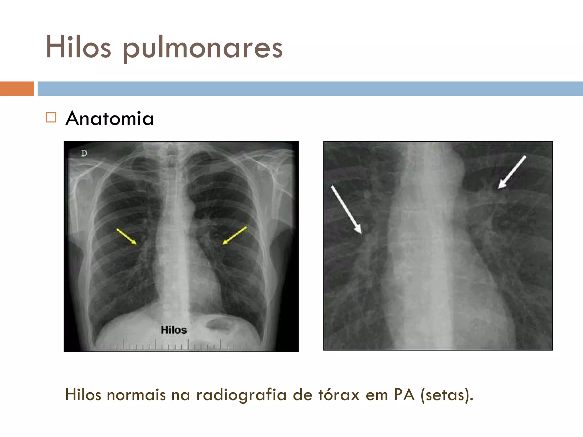 radiologia-tor-cica-hilos-pulmonares-e-doen-as-do-mediastino-ppt