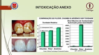 INTOXICAÇÃO ANEXO
16
 