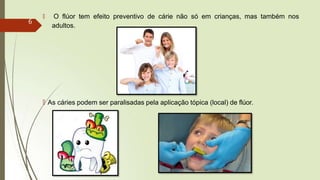 🠶 O flúor tem efeito preventivo de cárie não só em crianças, mas também nos
adultos.
🠶 As cáries podem ser paralisadas pela aplicação tópica (local) de flúor.
6
 