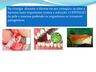 Na cirurgia durante a diérese no ato cirúrgico, se abre a
barreira mais importante contra a infecção: O EPITELIO
da pele e mucosa podendo os organismos se tornarem
patogênicos.
 