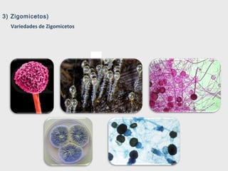 3) Zigomicetos)
Variedades de Zigomicetos
 