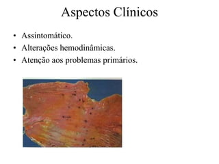 • Assintomático.
• Alterações hemodinâmicas.
• Atenção aos problemas primários.
Aspectos Clínicos
 