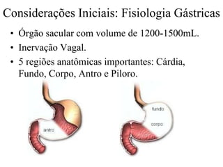 Considerações Iniciais: Fisiologia Gástricas
• Órgão sacular com volume de 1200-1500mL.
• Inervação Vagal.
• 5 regiões anatômicas importantes: Cárdia,
Fundo, Corpo, Antro e Piloro.
 