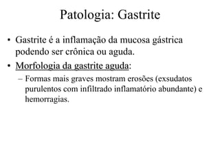 Patologia: Gastrite
• Gastrite é a inflamação da mucosa gástrica
podendo ser crônica ou aguda.
• Morfologia da gastrite aguda:
– Formas mais graves mostram erosões (exsudatos
purulentos com infiltrado inflamatório abundante) e
hemorragias.
 