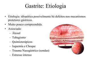 • Etiologia: idiopática possivelmente há defeitos nos mecanismos
protetores gástricos.
• Muito pouco compreendida.
• Associada:
– Álcool
– Tabagismo
– Quimioterápicos
– Isquemia e Choque
– Trauma Nasogástrico (sondas)
– Estresse intenso
Gastrite: Etiologia
 