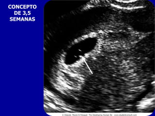 CONCEPTO
  DE 3,5
SEMANAS
 