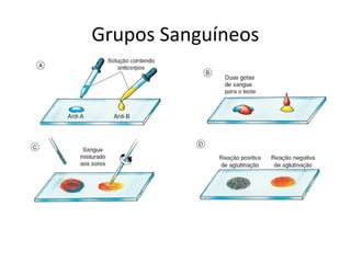 Grupos Sanguíneos
 