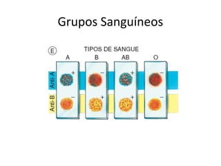 Grupos Sanguíneos
 