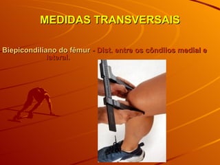 MEDIDAS TRANSVERSAIS Biepicondiliano do fêmur  - Dist. entre os côndilos medial e  lateral. 