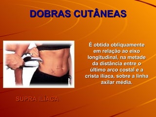 DOBRAS CUTÂNEAS SUPRA ILÍACA É obtida obliquamente em relação ao eixo longitudinal, na metade da distância entre o último arco costal e a crista ilíaca, sobre a linha axilar média. 