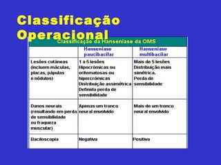 Classificação
Operacional
 