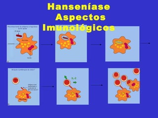 Hanseníase
Aspectos
Imunológicos
 
