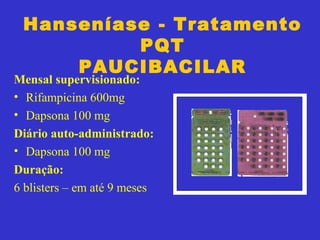 Hanseníase - Tratamento
PQT
PAUCIBACILAR
Mensal supervisionado:
• Rifampicina 600mg
• Dapsona 100 mg
Diário auto-administrado:
• Dapsona 100 mg
Duração:
6 blisters – em até 9 meses
 