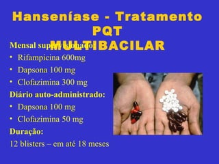 Hanseníase - Tratamento
PQT
MULTIBACILARMensal supervisionado:
• Rifampicina 600mg
• Dapsona 100 mg
• Clofazimina 300 mg
Diário auto-administrado:
• Dapsona 100 mg
• Clofazimina 50 mg
Duração:
12 blisters – em até 18 meses
 