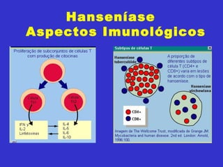 Hanseníase
Aspectos Imunológicos
 