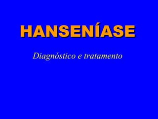 Diagnóstico e tratamento
HANSENÍASEHANSENÍASE
 