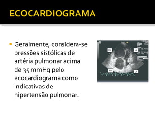 Geralmente, considera-se pressões sistólicas de artéria pulmonar acima de 35 mmHg pelo ecocardiograma como indicativas de hipertensão pulmonar. 