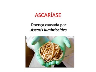 ASCARÍASE
Doença causada por
Ascaris lumbricoides
 
