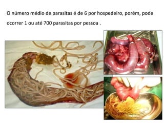 O número médio de parasitas é de 6 por hospedeiro, porém, pode
ocorrer 1 ou até 700 parasitas por pessoa .
 