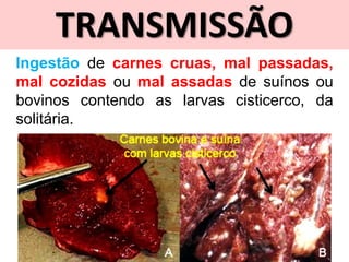 TRANSMISSÃO
Ingestão de carnes cruas, mal passadas,
mal cozidas ou mal assadas de suínos ou
bovinos contendo as larvas cisticerco, da
solitária.
 