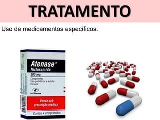 TRATAMENTO
Uso de medicamentos específicos.
 