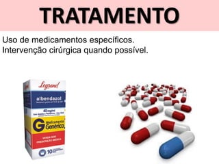 TRATAMENTO
Uso de medicamentos específicos.
Intervenção cirúrgica quando possível.
 