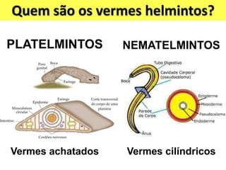 Quem são os vermes helmintos?
PLATELMINTOS NEMATELMINTOS
Vermes achatados Vermes cilíndricos
 