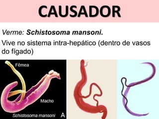 CAUSADOR
Verme: Schistosoma mansoni.
Vive no sistema intra-hepático (dentro de vasos
do fígado)
 