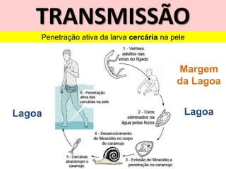 TRANSMISSÃO
Penetração ativa da larva cercária na pele
Lagoa
Margem
da Lagoa
Lagoa
 