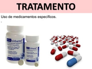 TRATAMENTO
Uso de medicamentos específicos.
.
 