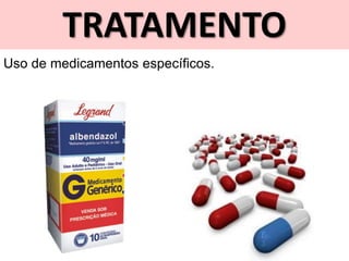 TRATAMENTO
Uso de medicamentos específicos.
 