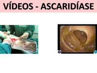 VÍDEOS - ASCARIDÍASE
 