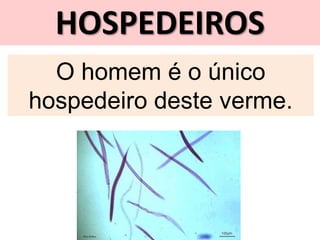 HOSPEDEIROS
O homem é o único
hospedeiro deste verme.
 