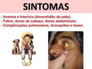 SINTOMAS
- Anemia e Icterícia (Amarelidão da pele);
- Febre, dores de cabeça, dores abdominais;
- Complicações pulmonares, bronquites e tosse.
 