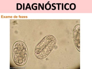 DIAGNÓSTICO
Exame de fezes
 