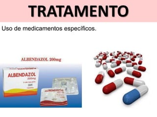 TRATAMENTO
Uso de medicamentos específicos.
 