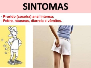 SINTOMAS
- Prurido (coceira) anal intensa;
- Febre, náuseas, diarreia e vômitos.
 