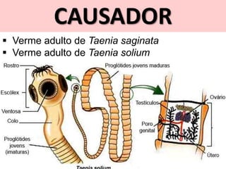 CAUSADOR
 Verme adulto de Taenia saginata
 Verme adulto de Taenia solium
 