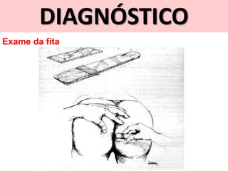 DIAGNÓSTICO
Exame da fita
 