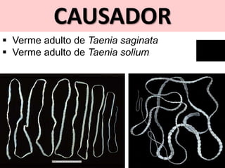 CAUSADOR
 Verme adulto de Taenia saginata
 Verme adulto de Taenia solium
 
