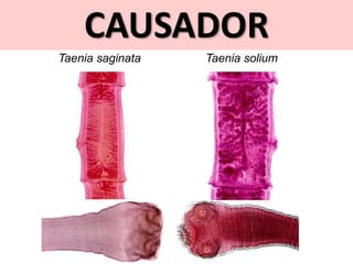 CAUSADOR
Taenia saginata Taenia solium
 