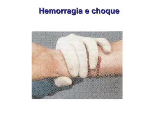 Hemorragia e choque 