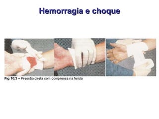 Hemorragia e choque 