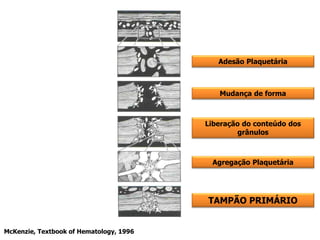 McKenzie, Textbook of Hematology, 1996
Adesão Plaquetária
Mudança de forma
Liberação do conteúdo dos
grânulos
TAMPÃO PRIMÁRIO
Agregação Plaquetária
 