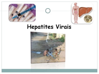 Hepatites Virais
 