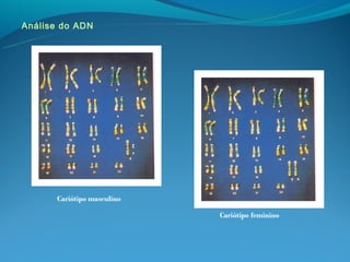 Análise do ADN




      Cariótipo masculino

                            Cariótipo feminino
 