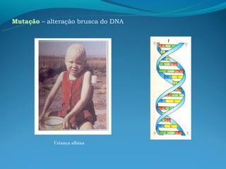 Mutação – alteração brusca do DNA




            Criança albina
 