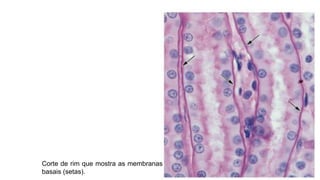 Corte de rim que mostra as membranas
basais (setas). 13
 