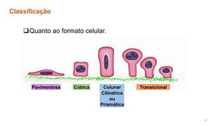 ❑Quanto ao formato celular.
Classificação
Pavimentosa Cúbica Colunar
Cilíndrica
ou
Prismática
Transicional
16
 