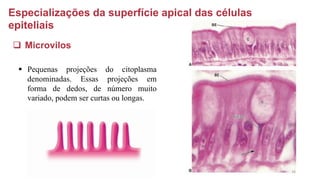 Especializações da superfície apical das células
epiteliais
❑ Microvilos
▪ Pequenas projeções do citoplasma
denominadas. Essas projeções em
forma de dedos, de número muito
variado, podem ser curtas ou longas.
26
 